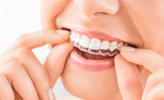 hand holding clear teeth aligners in mouth, Invisalign West Orange, NJ, cosmetic dentistry