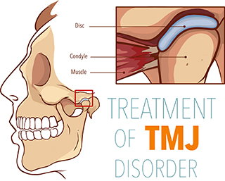 TMD